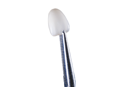 zirconia veneers