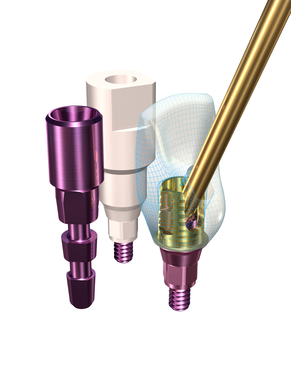 implant-direct-bundle-southern-cross-dental